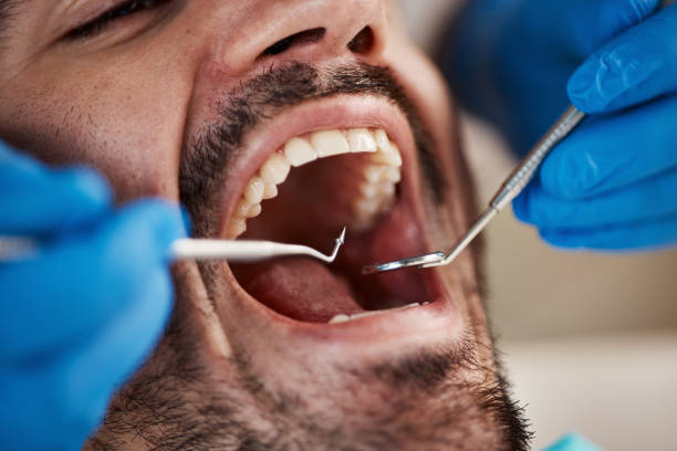 Best Emergency Denture Repair in Brookshire, TX